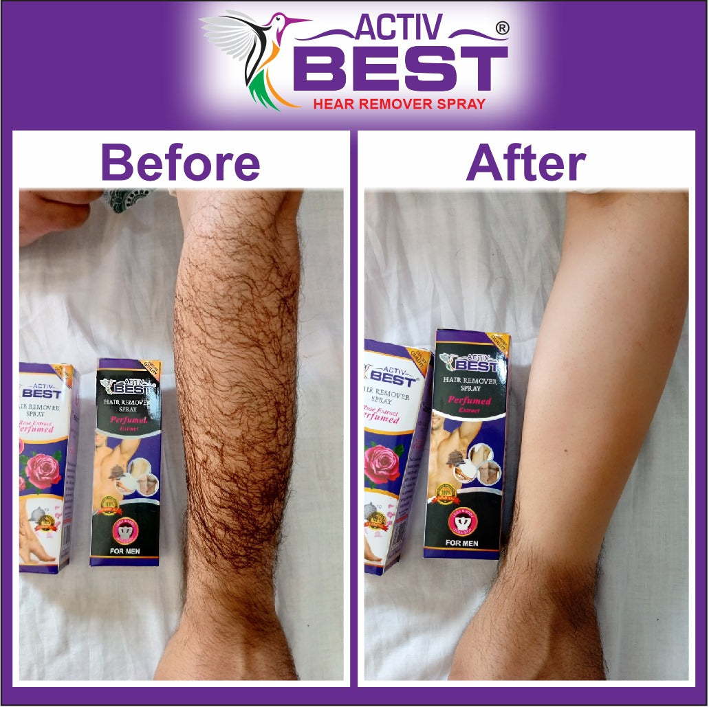 HAIR REMOVER SPRAY FOR MEN