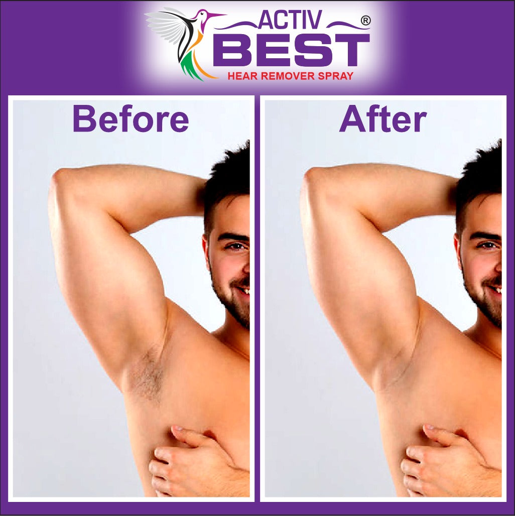 HAIR REMOVER SPRAY FOR MEN