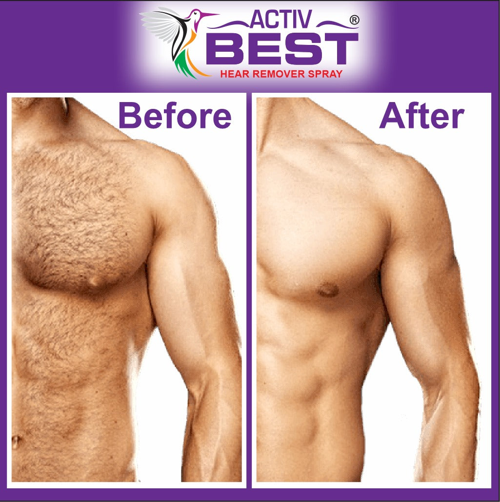 HAIR REMOVER SPRAY FOR MEN